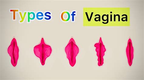 vaginal lip pictures